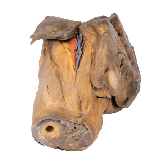 Erler-Zimmer MP1142 Žmogaus Pilvo 3D Modelis