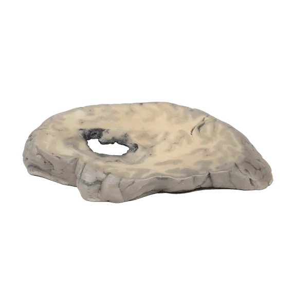 Erler-Zimmer MP2002 Smegenų Kraujavimo 3D Modelis