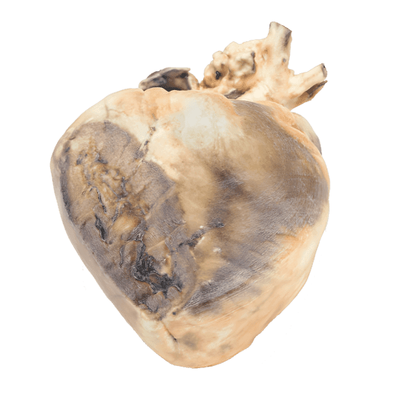 Erler-Zimmer MP2032 Prieširdžių Pertvaros Defekto 3D Modelis