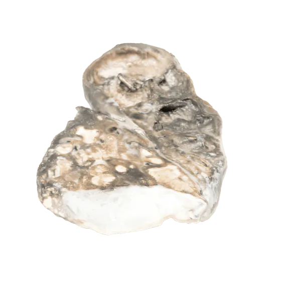 Erler-Zimmer MP2054 Fibrokazinės Tuberkuliozės 3D Modelis