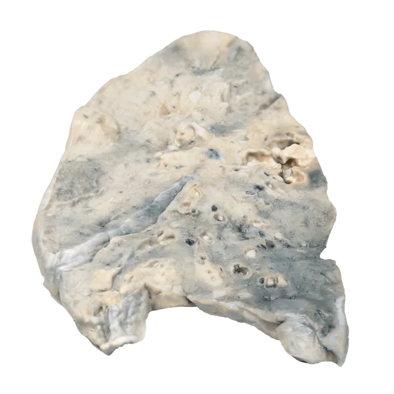 Erler-Zimmer MP2064 Plaučių Stafilokoko 3D Modelis