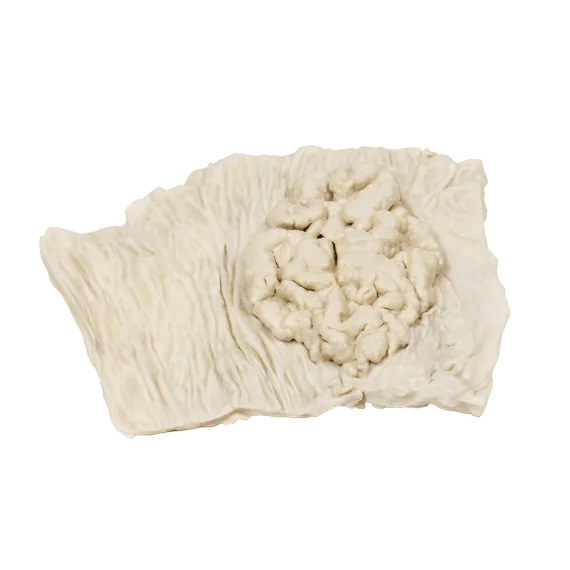 Erler-Zimmer MP2071 Storosios Žarnos Gaurelių Adenomos 3D Modelis