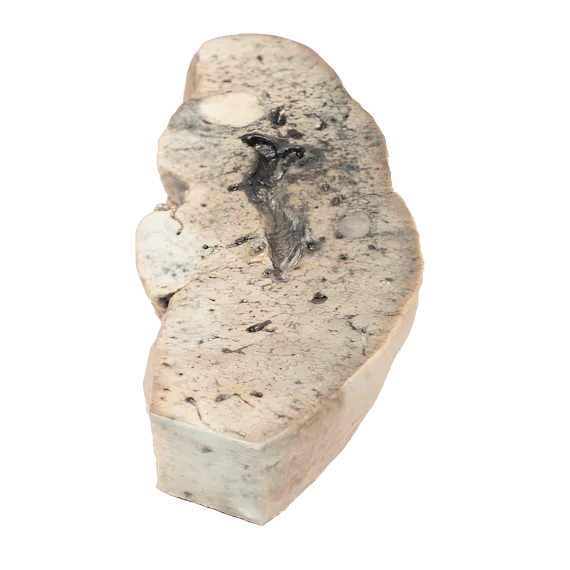 Erler-Zimmer MP2073 Kepenų Cirozės 3D Modelis