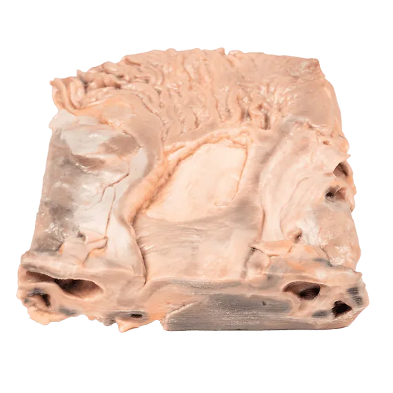Erler-Zimmer MP2076 Lėtinės Skrandžio Opos 3D Modelis