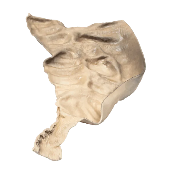 Erler-Zimmer MP2079 Hirschsprungo Ligos 3D Modelis