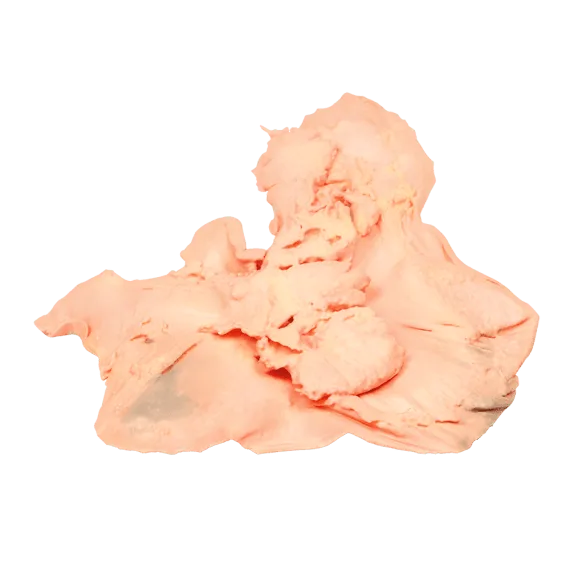 Erler-Zimmer MP2080 Skrandžio Adenokarcinomos 3D Modelis