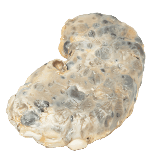 Erler-Zimmer MP2091 Policistinės Inkstų Ligos 3D Modelis