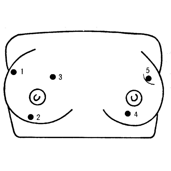 Erler-Zimmer LM17 Krūtinės Vėžio Palpacijos Modelis