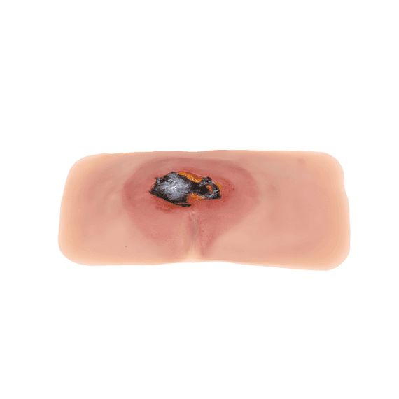 Erler-Zimmer PW001A Pragulos Žaizdos Sakralinis Muliažas