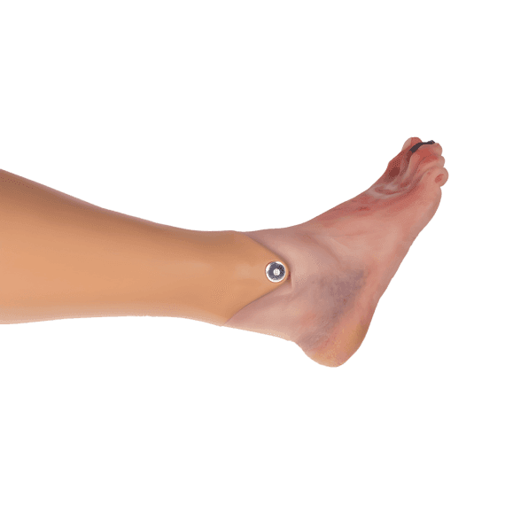 Erler-Zimmer PW006P Diabetinės Pėdos Sindromo Modelis