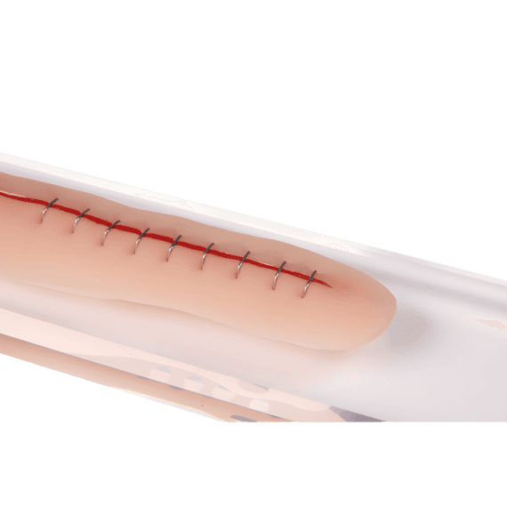 Erler-Zimmer PW009C Chirurginių Žaizdų Muliažai