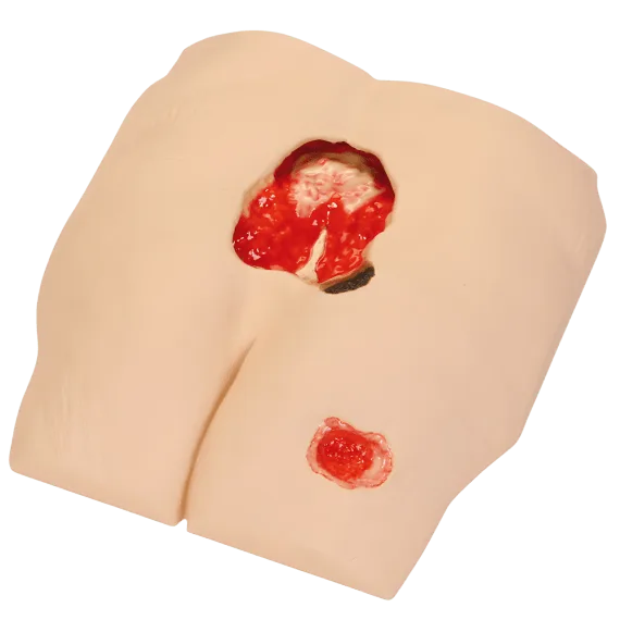 Erler-Zimmer R10172 "Stan" 4 Pakopos Pragulų Modelis