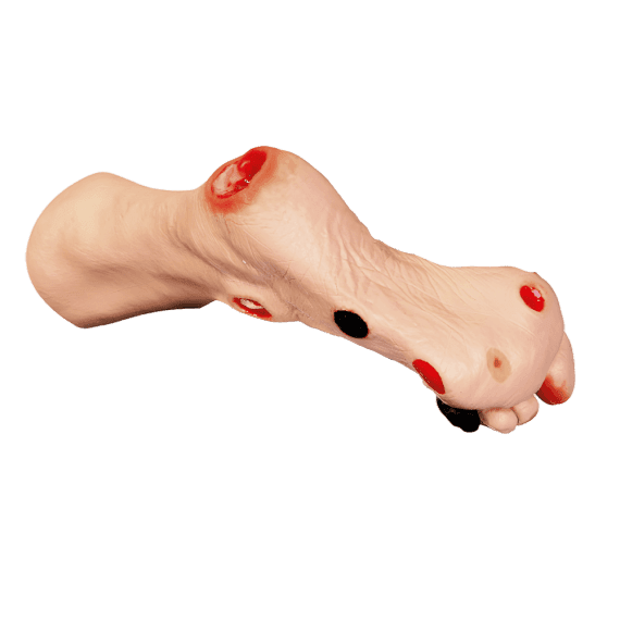 Erler-Zimmer R10227 "Wilma" Pėdų Žaizdų Modelis