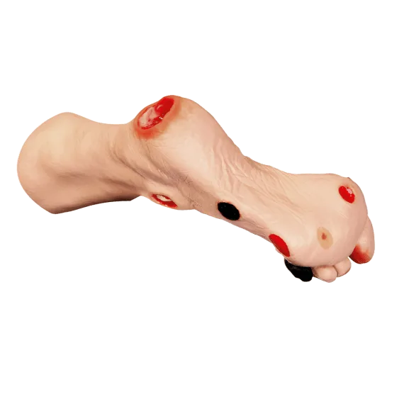 Erler-Zimmer R10227 "Wilma" Pėdų Žaizdų Modelis