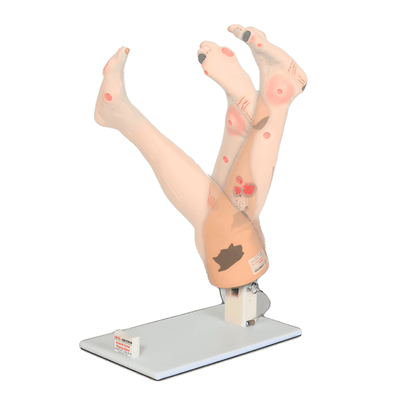 Erler-Zimmer R11020A "Vinnie" Kojų Venų Nepakankamumo Modelis