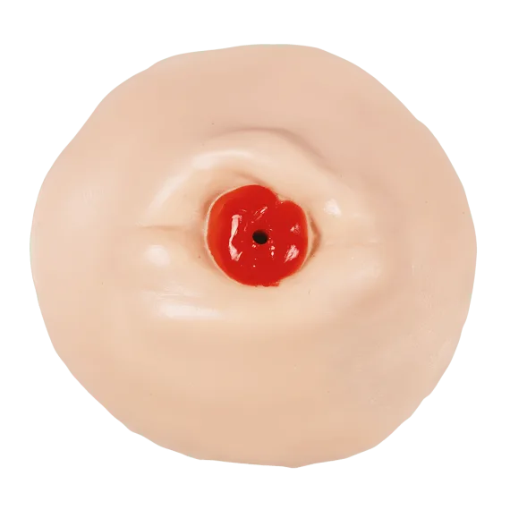 Erler-Zimmer R11040 Atitrauktos Ostomijos Priežiūros Mokymo Modelis